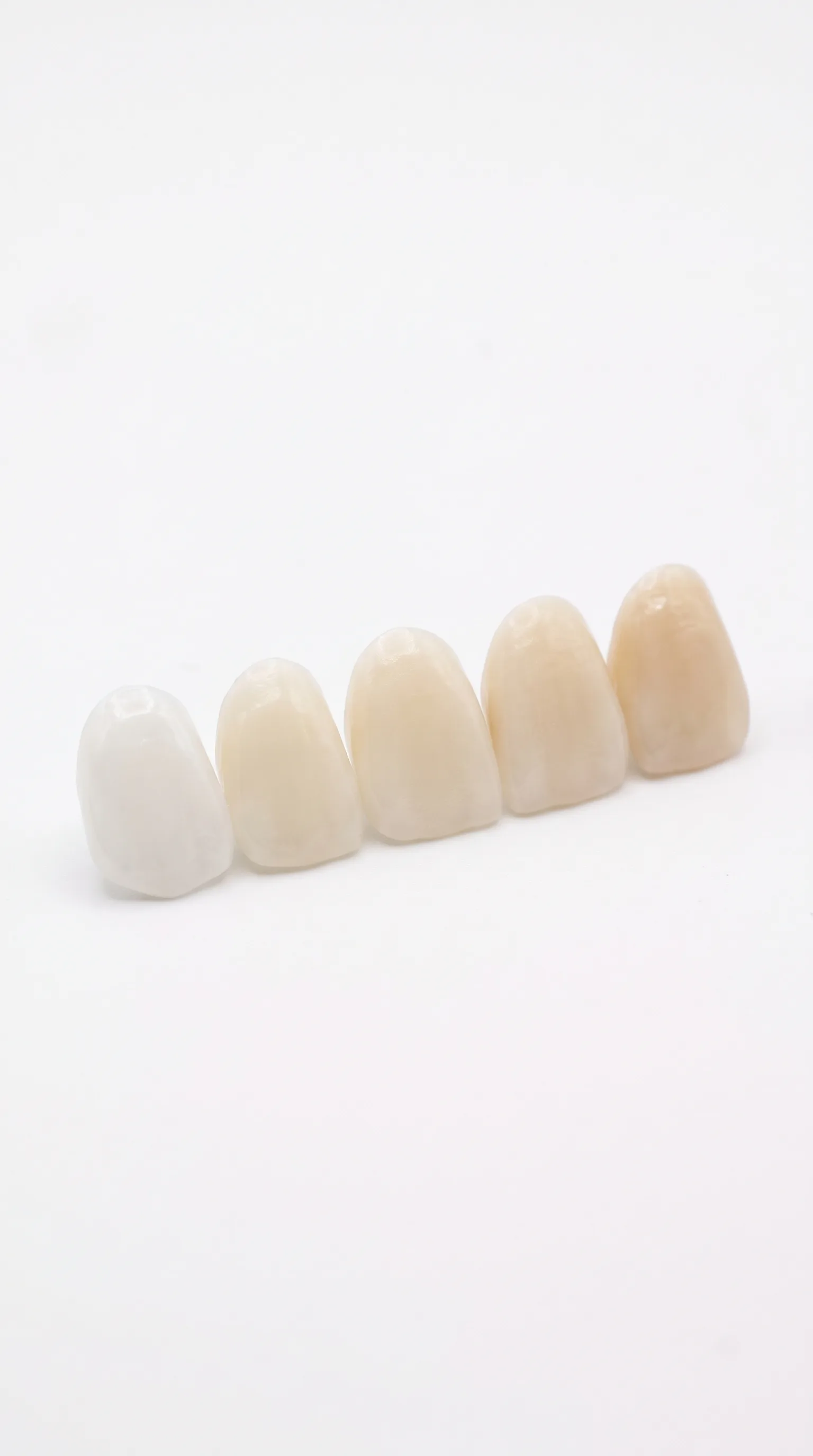 Nuanțe de culori disponibile pentru fațete dentare ceramice Emax