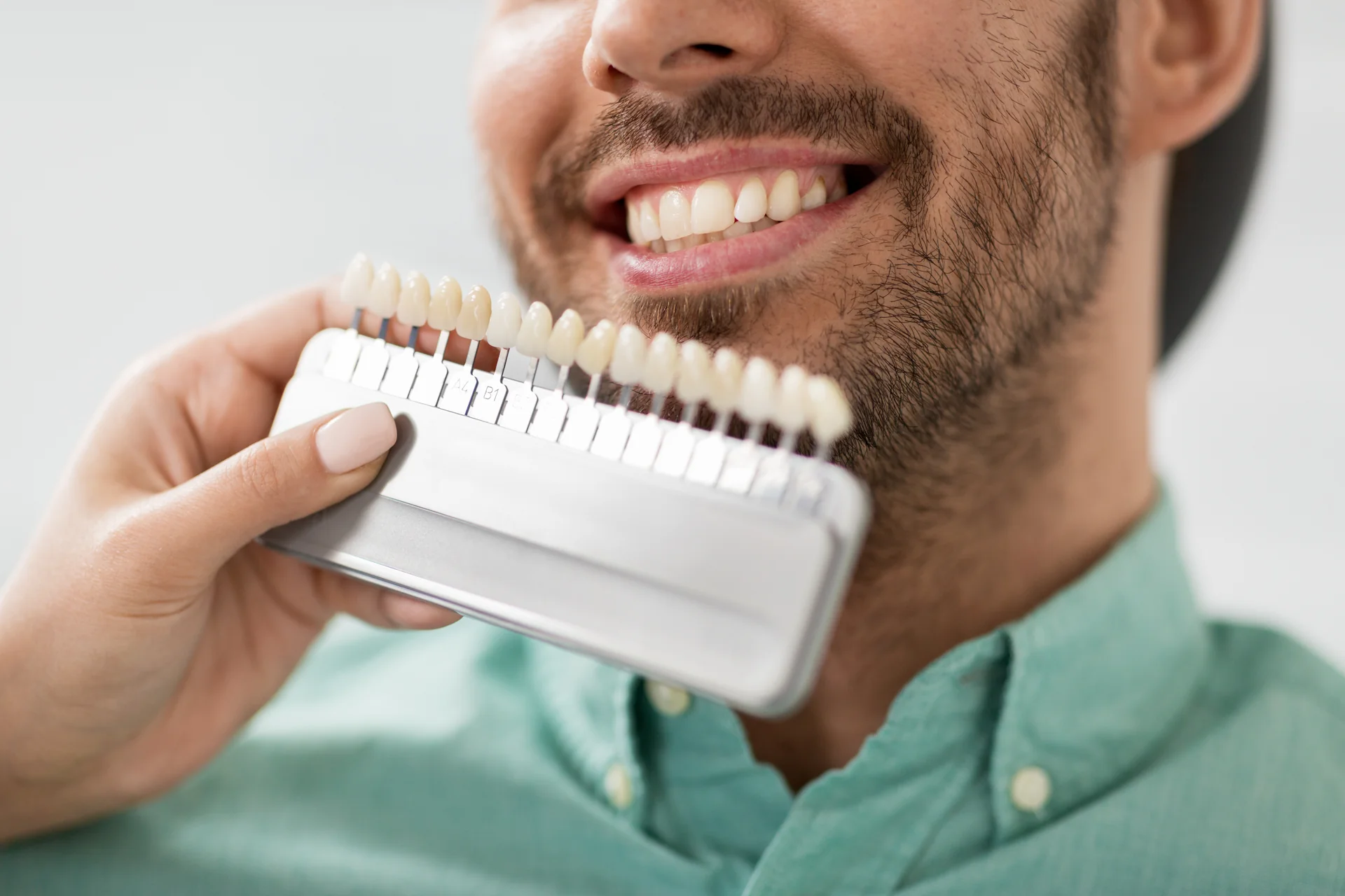 Fațetele dentare: când sunt o opțiune bună și ce trebuie să știți