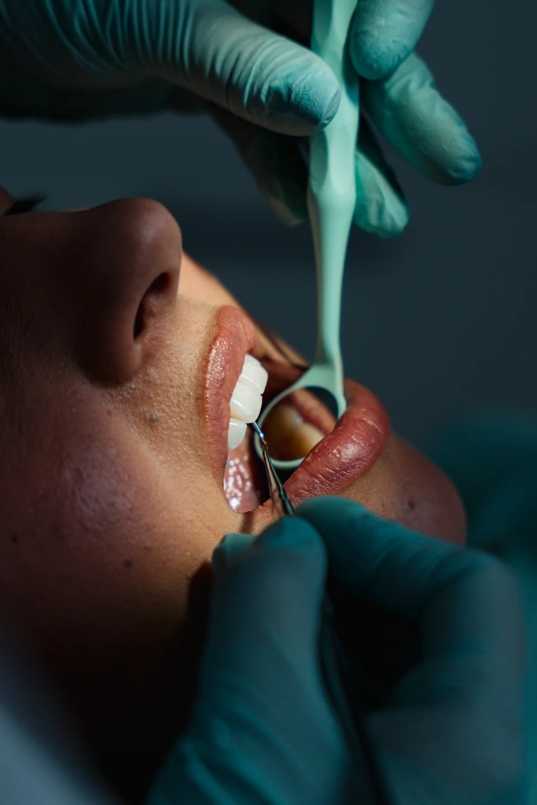 Consultație stomatologică Denteca Smile Clinic, expertiză și tehnologie de ultimă oră